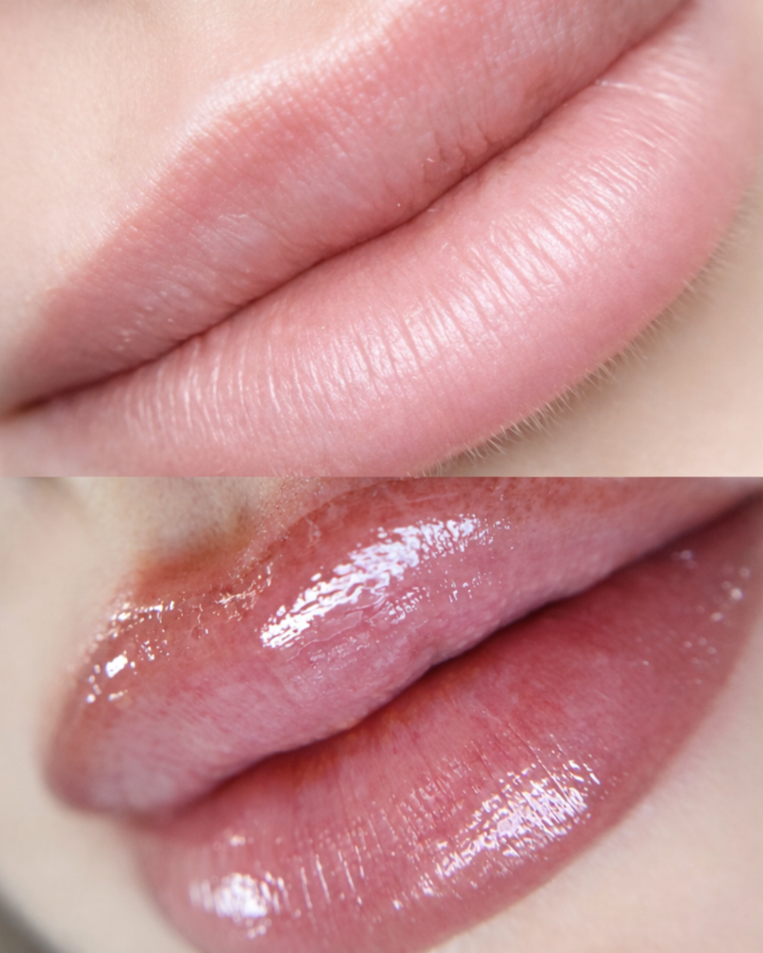 Young Lips