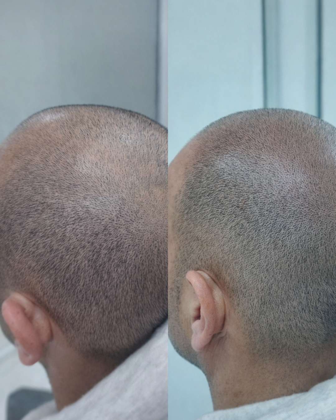 REALSCALP
