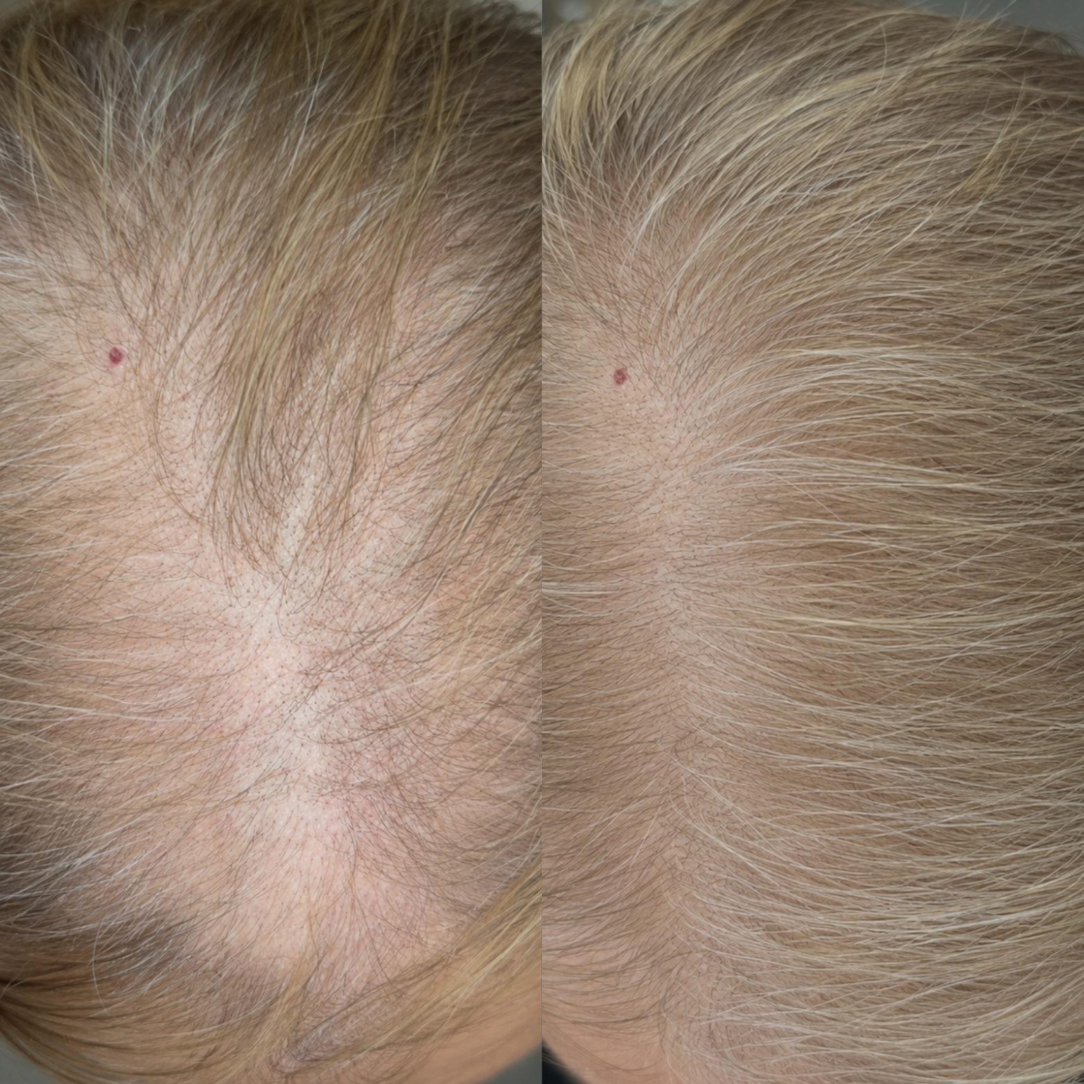 REALSCALP