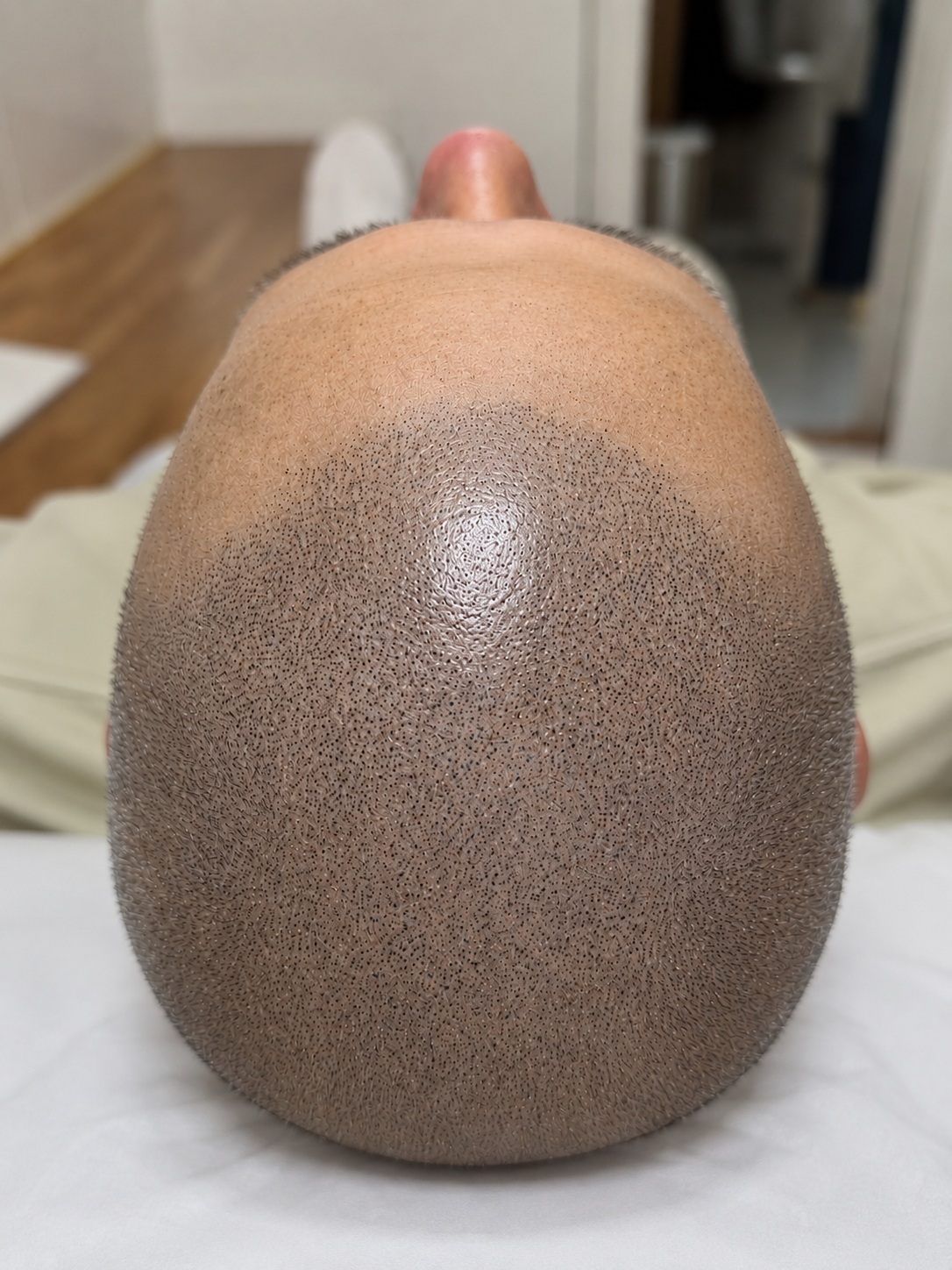 REALSCALP