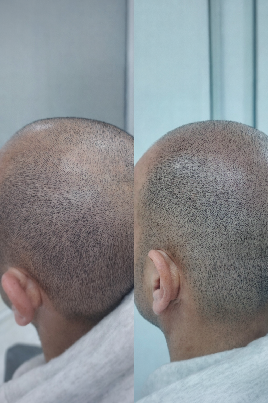 realscalp (1)